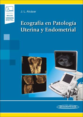 Alcazar: Ecografía en Patología Uterina y Endometrial