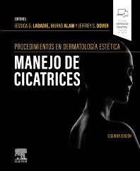 Procedimientos en dermatología cosmética: manejo de cicatrices