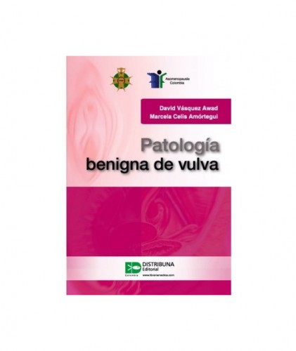 Patología benigna de vulva