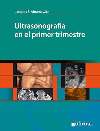 Ultrasonografía en el primer trimestre.