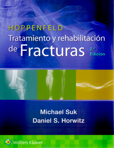 Hoppenfeld. Tratamiento y rehabilitación de fracturas 2 Ed.