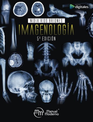 Imagenología. Ríos Briones, Nidia Isabel
