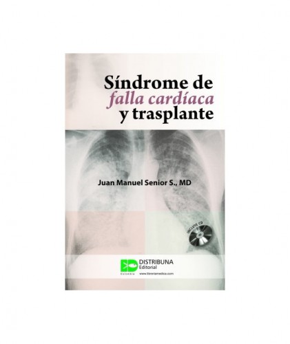 Síndrome de falla cardíaca y trasplante